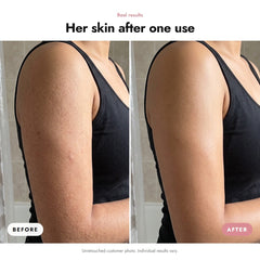 ÖVIE Collagen Body Scrub 3