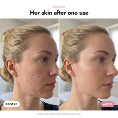 ÖVIE Collagen Face Scrub 3