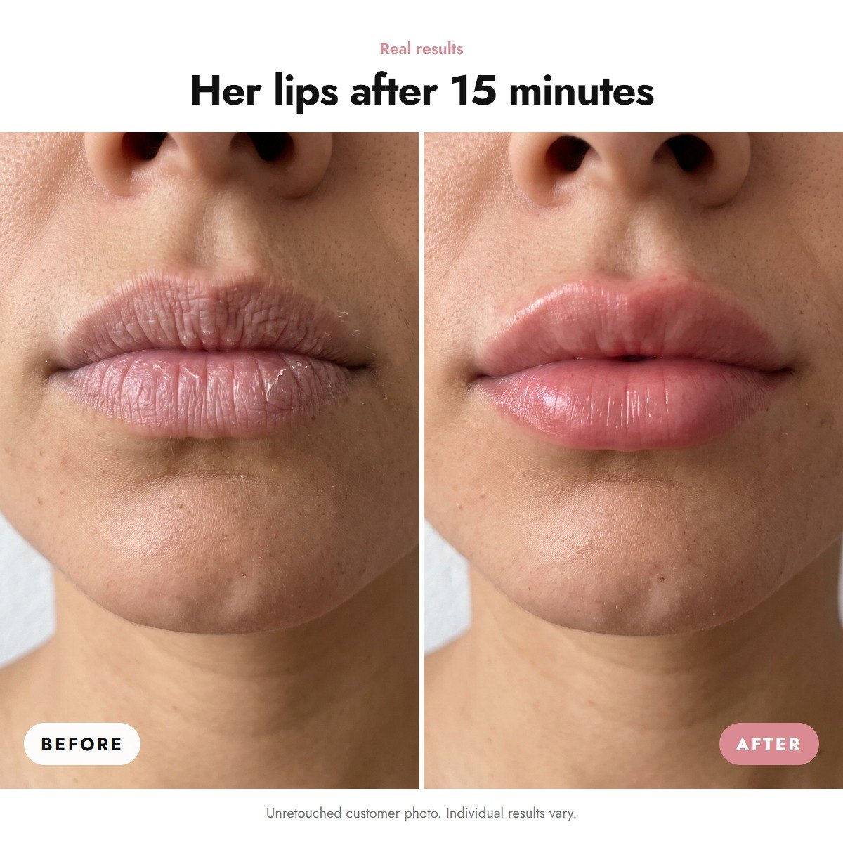 ÖVIE Collagen Lip Patch 3