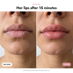 ÖVIE Collagen Lip Patch 3