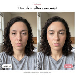 ÖVIE Hydrating Face Mist 3