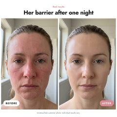 ÖVIE Hydro Cera-Nol Barrier Masks 3