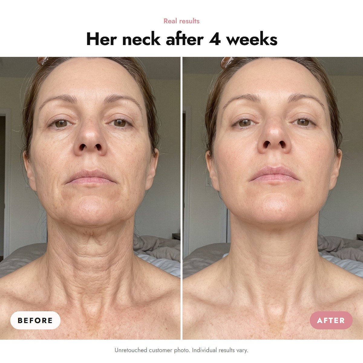 ÖVIE Marine Collagen Neck Mask 3