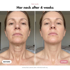 ÖVIE Marine Collagen Neck Mask 3