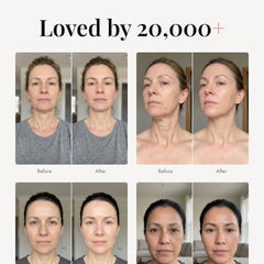 ÖVIE Marine Collagen Neck Mask 6