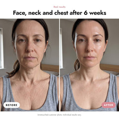 ÖVIE Masks in Synergy 3