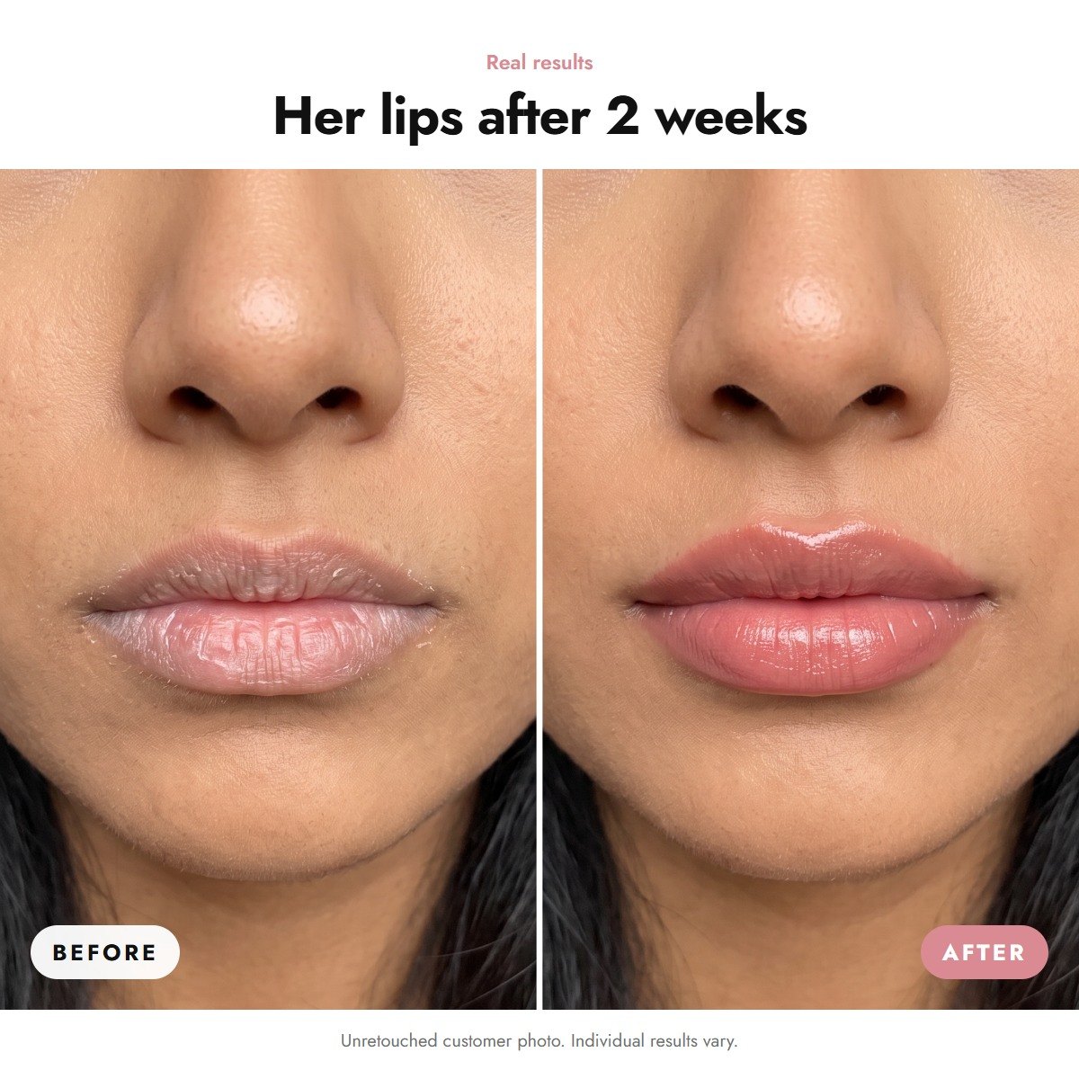 ÖVIE Complete Lip Kit 3