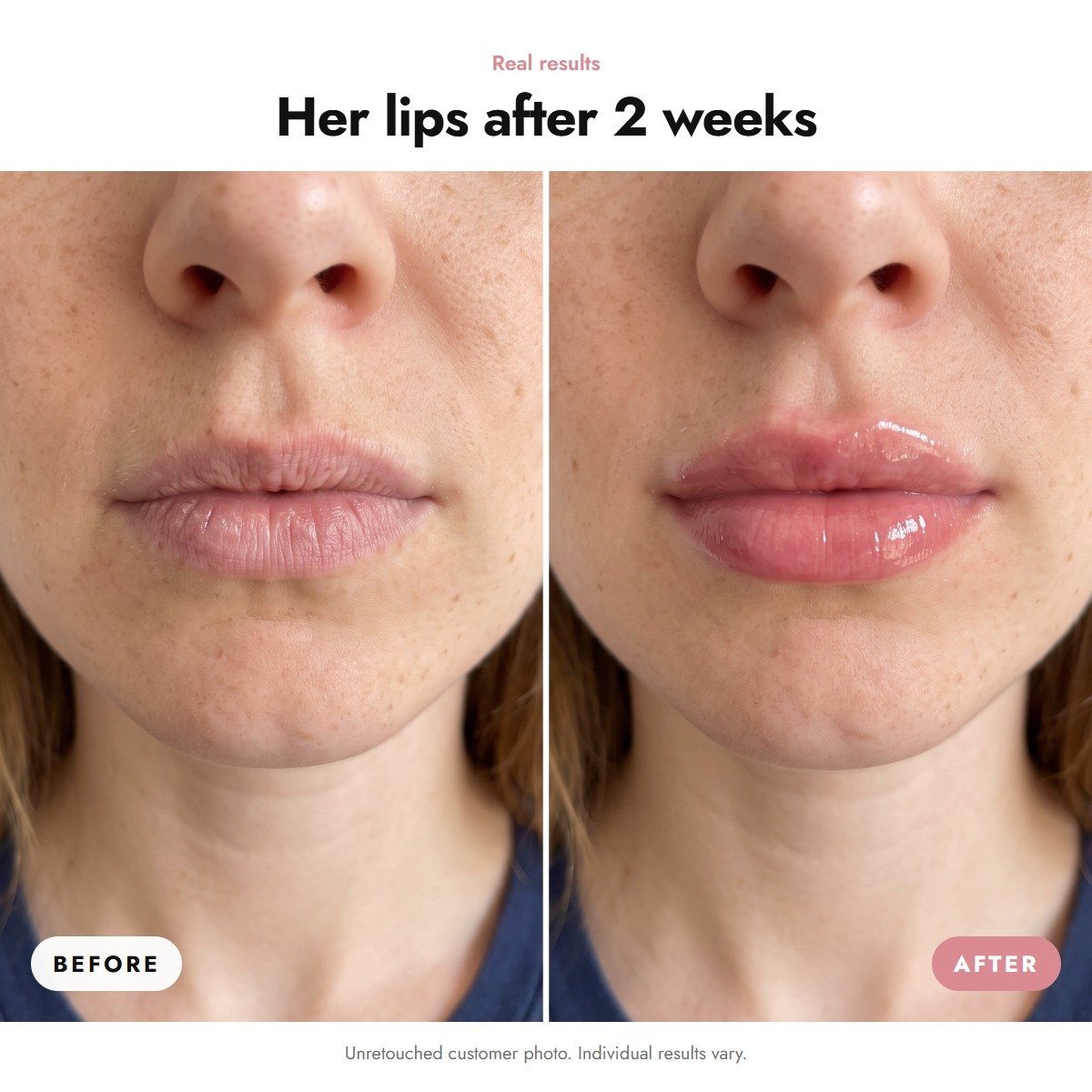 ÖVIE Complete Lip Routine Set 3