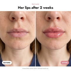 ÖVIE Complete Lip Routine Set 3