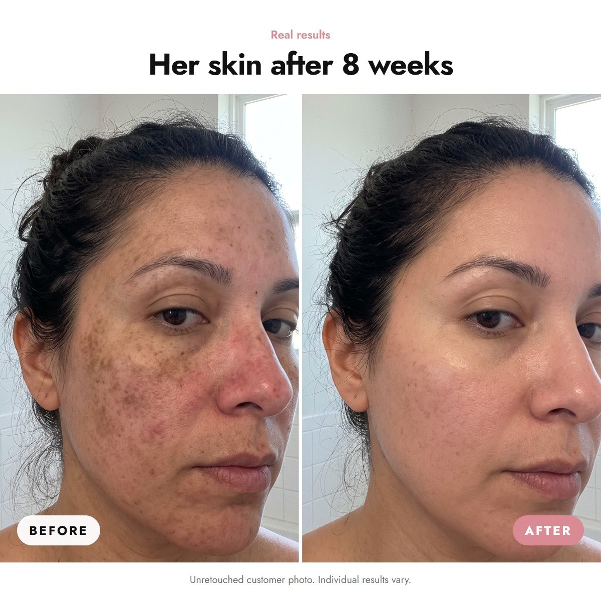 ÖVIE 3-Step Even Skin Tone Set 3