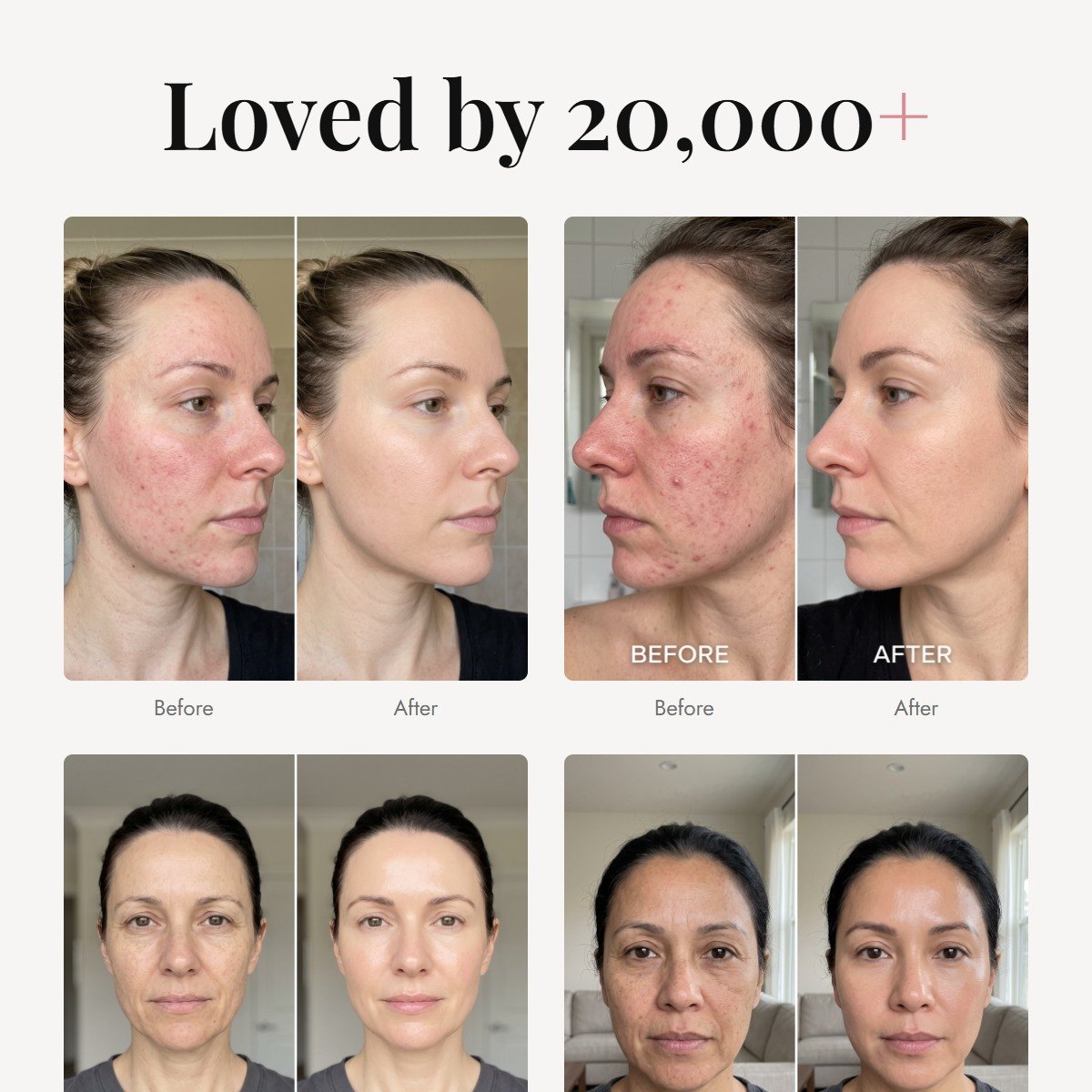 ÖVIE 3-Step Even Skin Tone Set 6