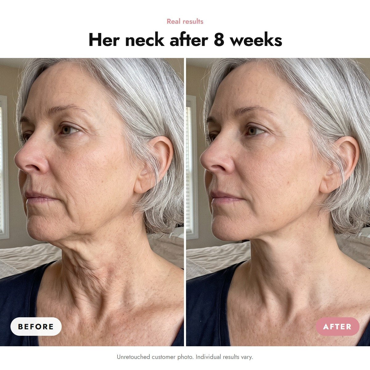 ÖVIE Firming Neck Cream 3