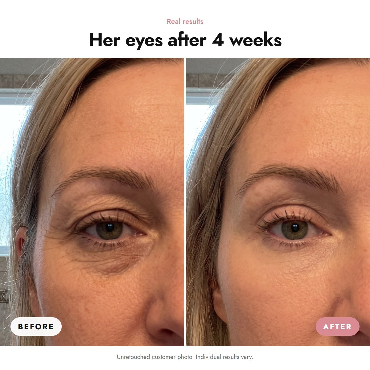 ÖVIE Lifting Eye Gel 3