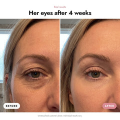 ÖVIE Lifting Eye Gel 3