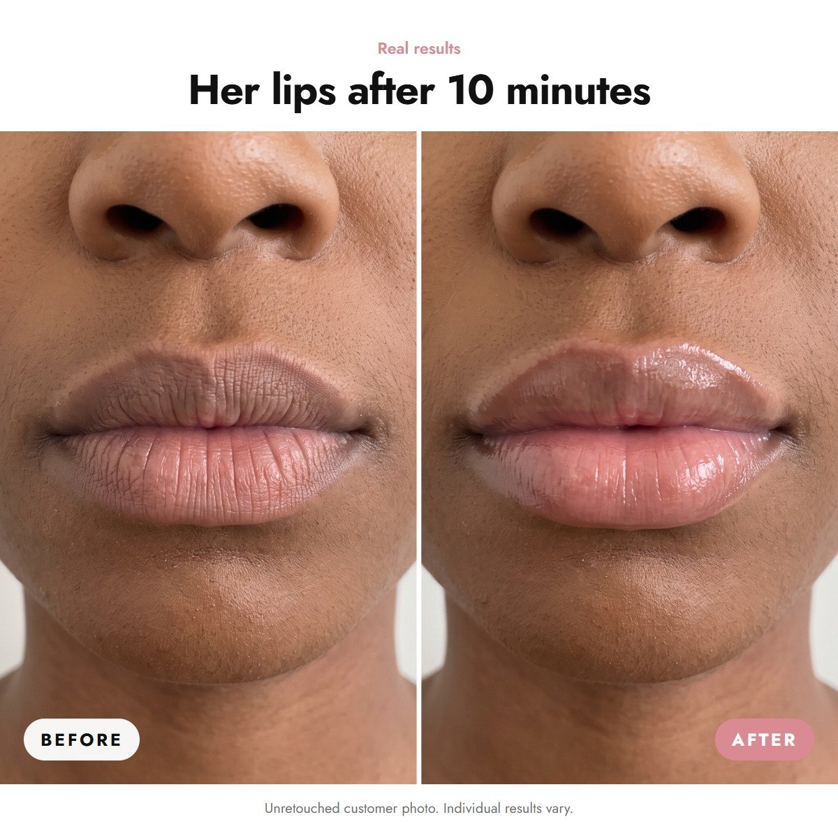ÖVIE Lip Plumper 3