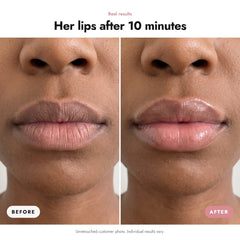 ÖVIE Lip Plumper 3