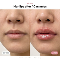 ÖVIE Plump & Shine Duo 3