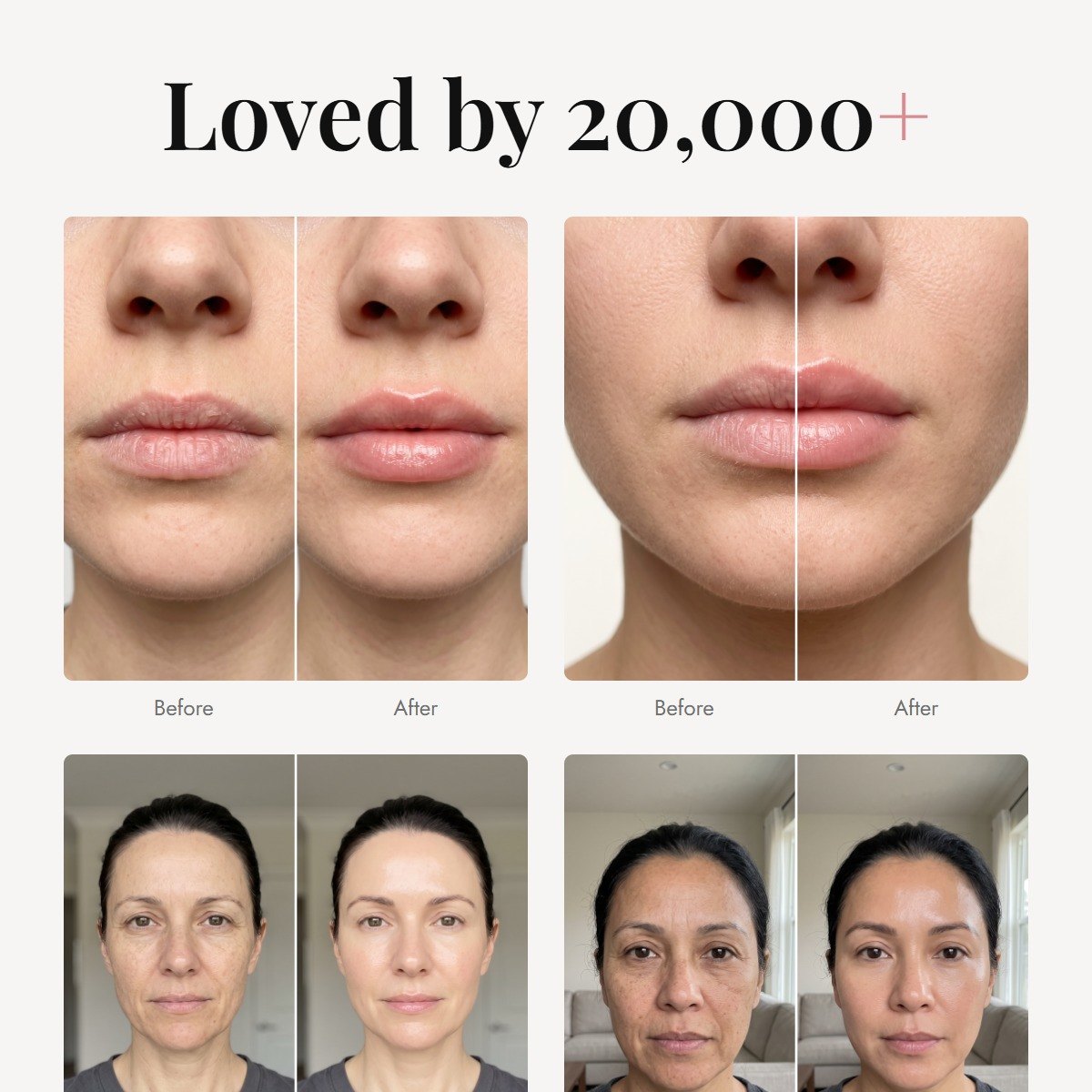 ÖVIE Smooth & Repair Duo 6