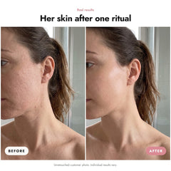 ÖVIE Total Exfoliation Set 3