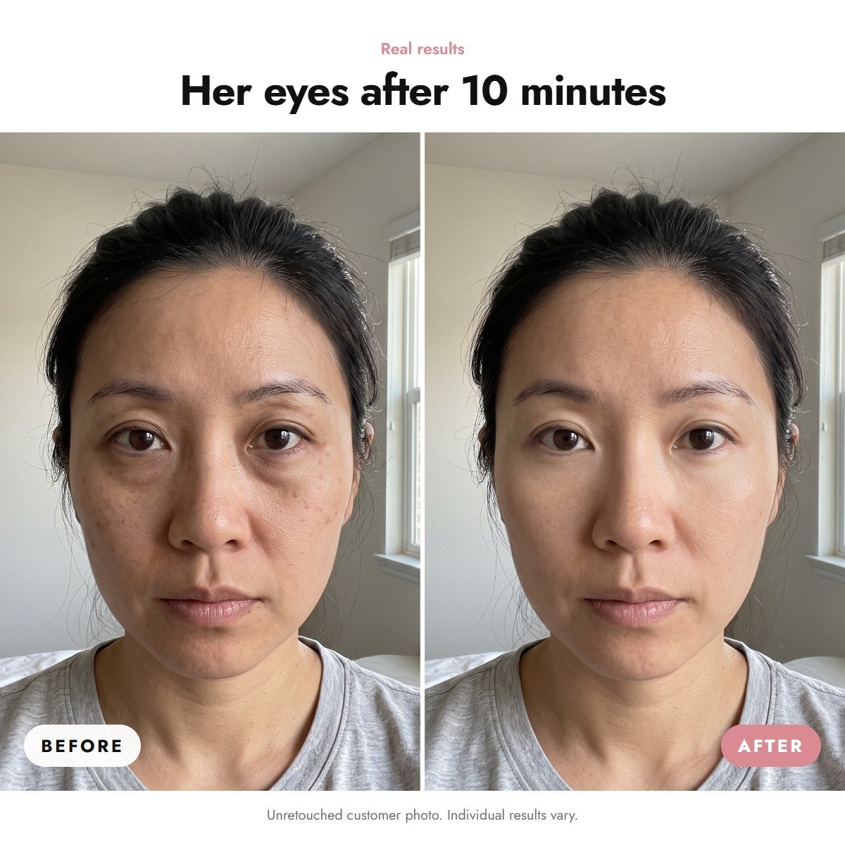 ÖVIE Plumping Gold Eye Patches 3