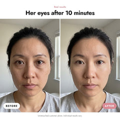 ÖVIE Plumping Gold Eye Patches 3