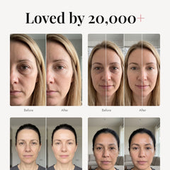ÖVIE Plumping Gold Eye Patches 6