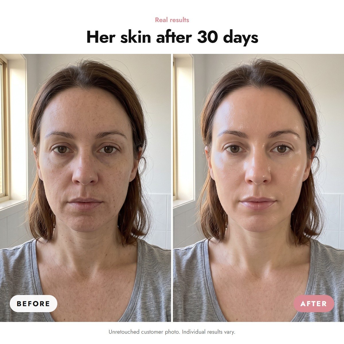 ÖVIE The Regenerating Routine 3