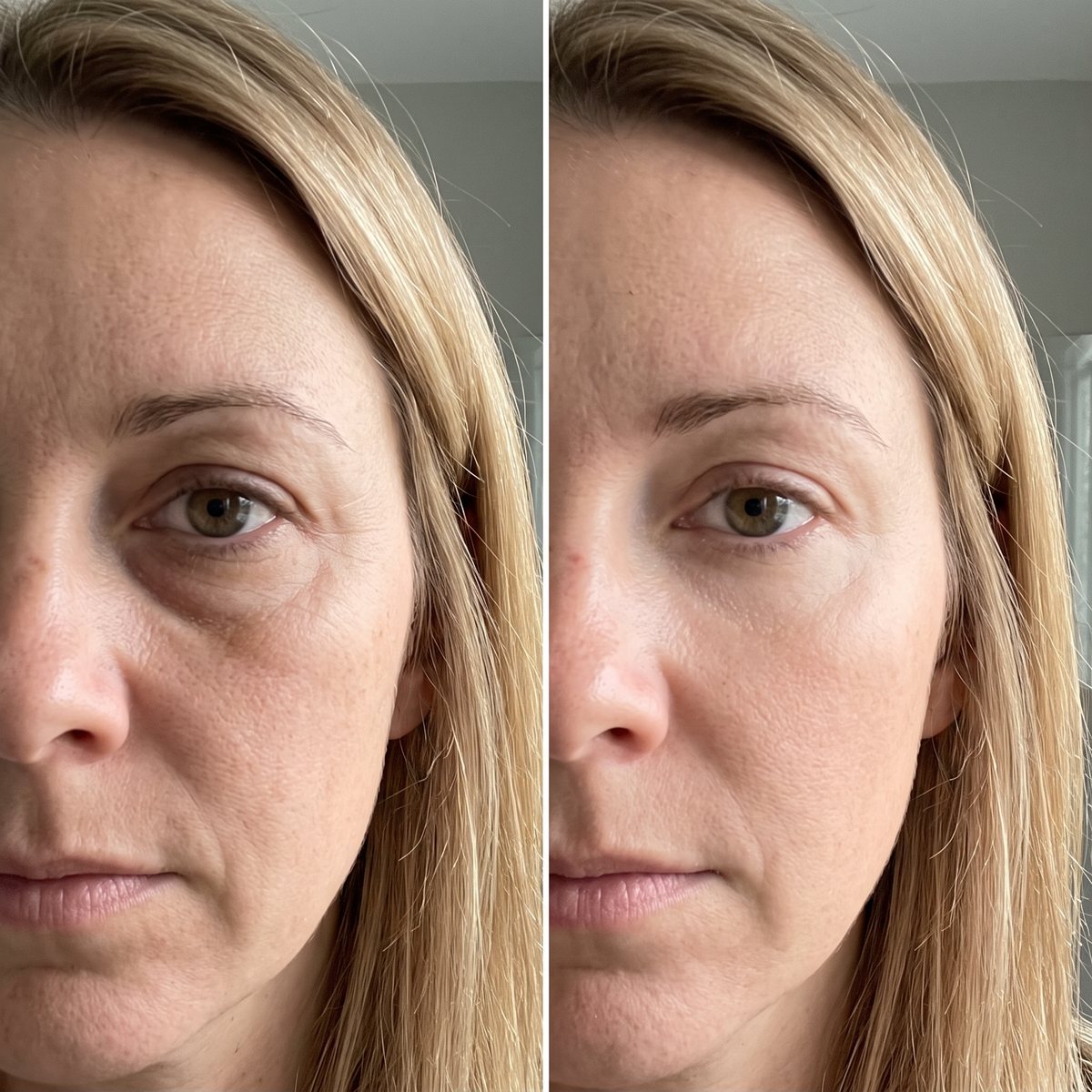 Before and After